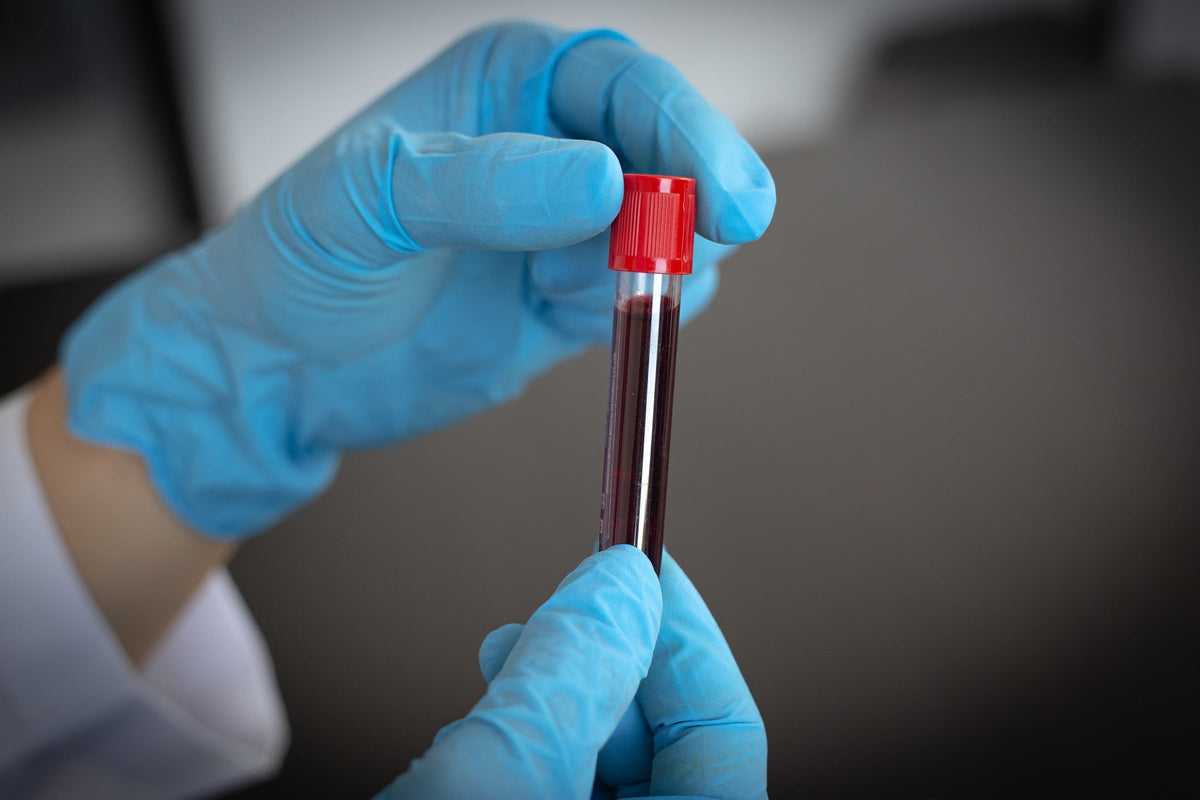 Blue-gloved hands holding a red-capped tube containing a blood sample.