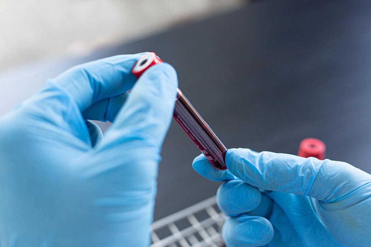 Blue-gloved hands holding a red-capped blood sample tube above a laboratory rack.