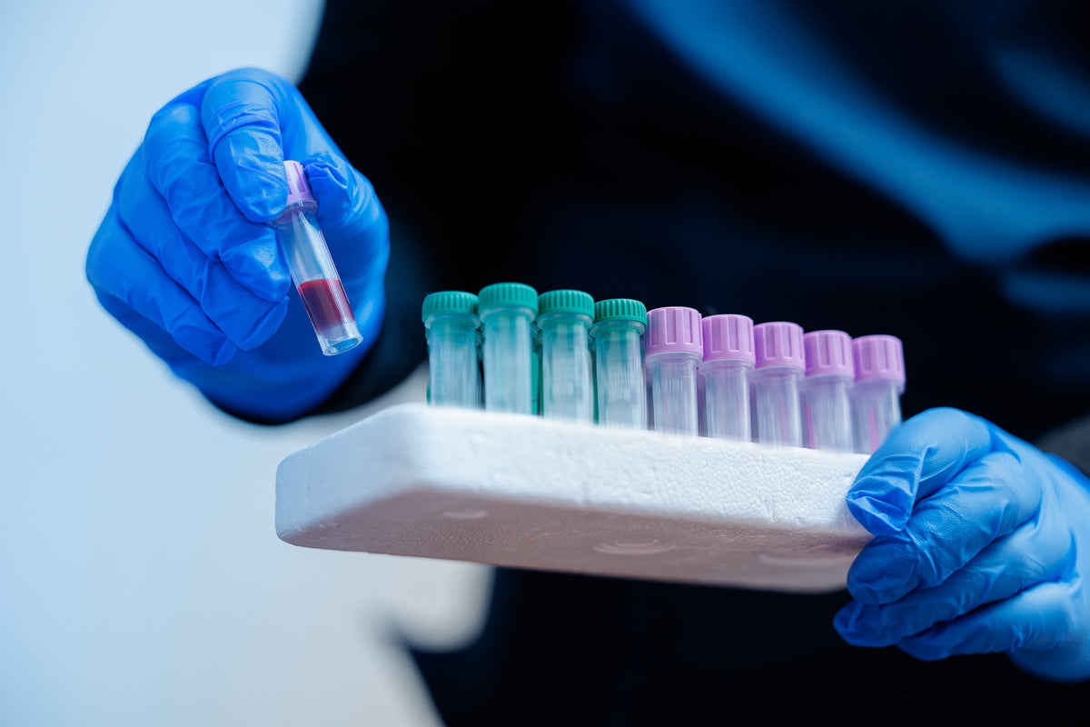Blue-gloved laboratory worker holding a blood sample tube above a rack of collection tubes.