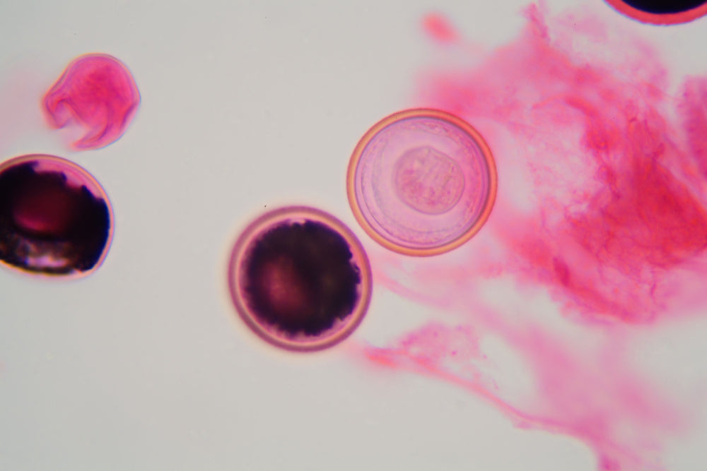 Roundworms in Humans: How to Spot, Prevent, and Protect Your Family