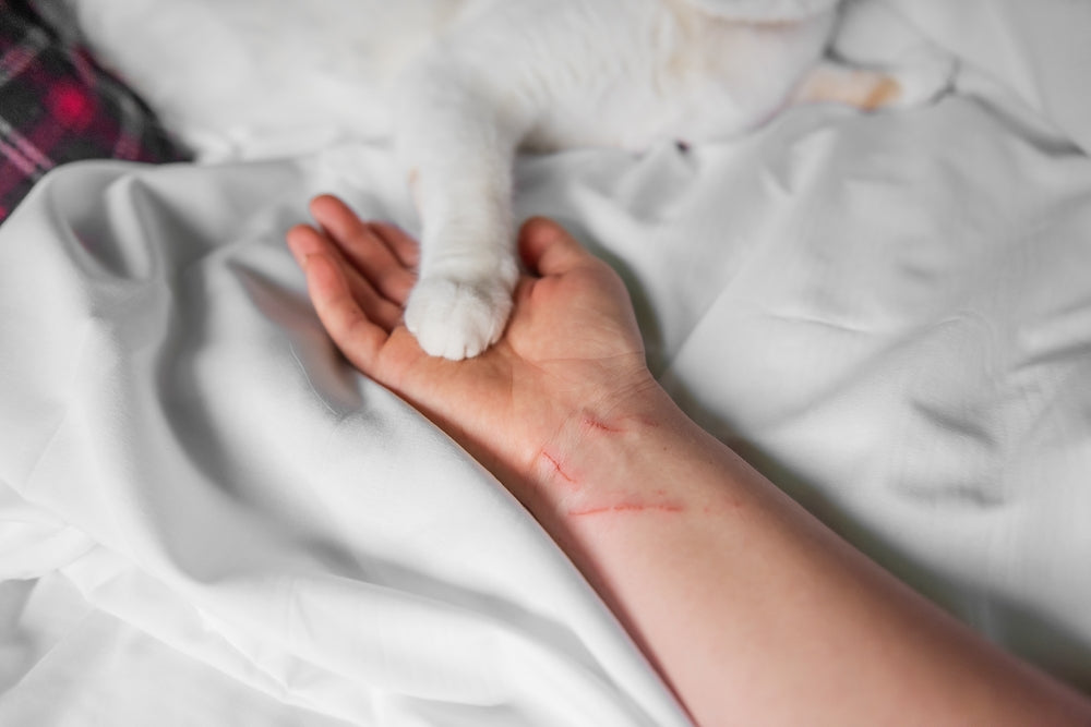 Cat Scratch Disease: Symptoms, Treatment and Human Risk